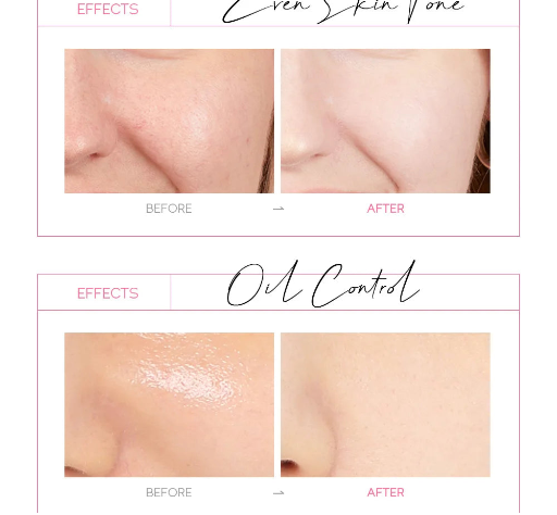 Anti Wrinkle Whitening Blackhead Removal