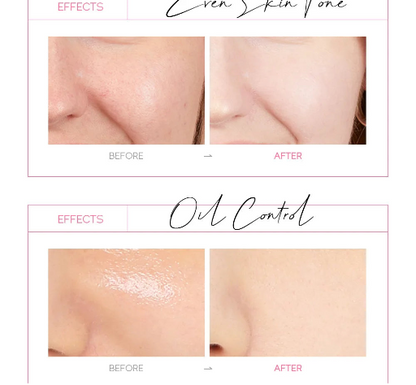 Anti Wrinkle Whitening Blackhead Removal